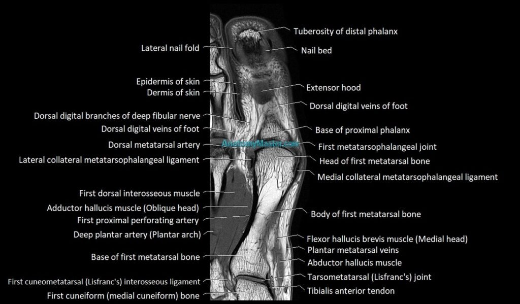 Great Toe micro anatomy MRI axial cross sectional 3T image