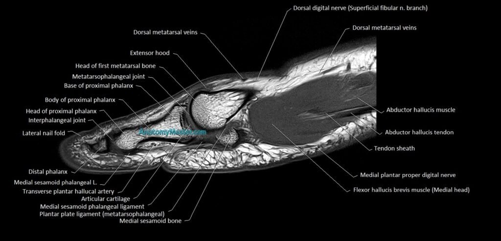 Hallux or big toe sagittal anatomy 3T MRI image