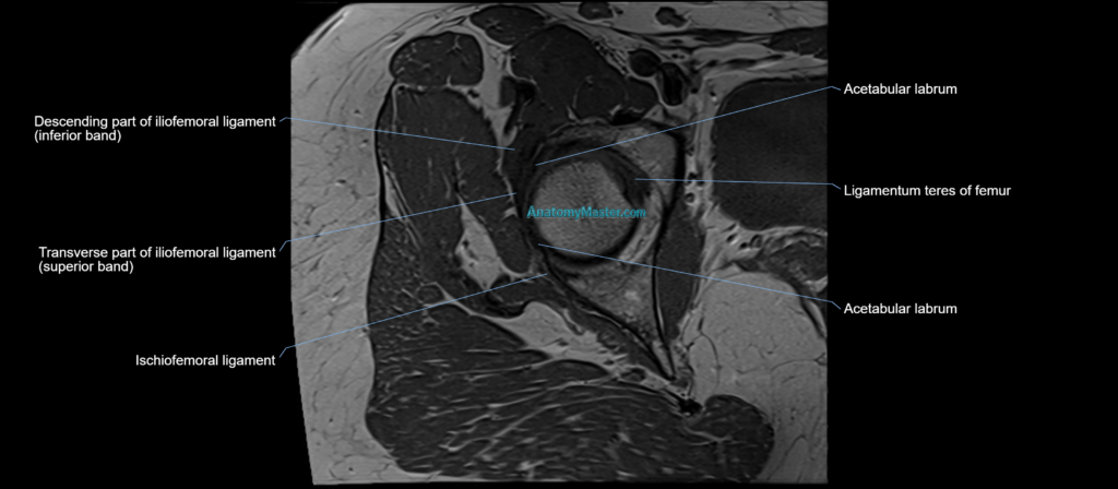 Hip ligament anatomy axial 3T MRI image -