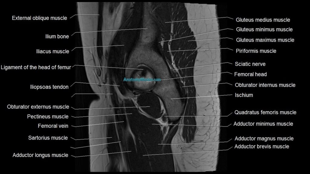 Hip sagittal cross sectional anatomy image