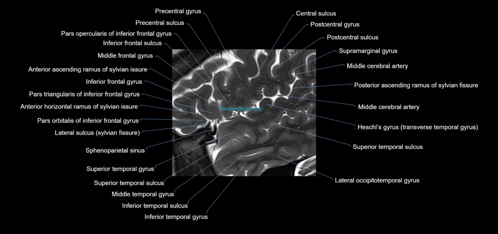 Insula cross section anatomy MRI sagittal 3t image