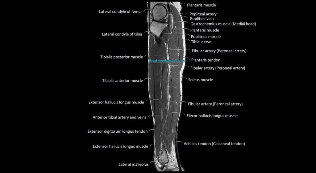 Lower leg sagittal anatomy 3T MRI image