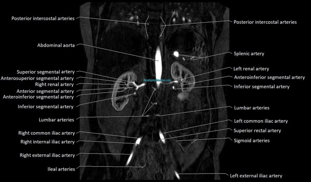 MRA Abdomen coronal anatomy image