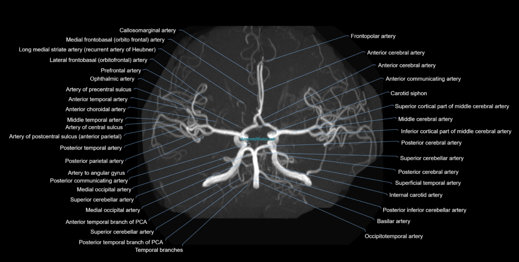 MRA Brain axial mip anatomy 3T MRI images