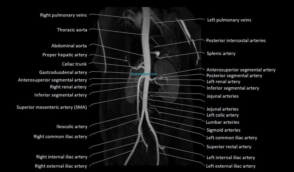 MRA abdomen (renal and mesenteric) angiography MIP 3D anatomy image