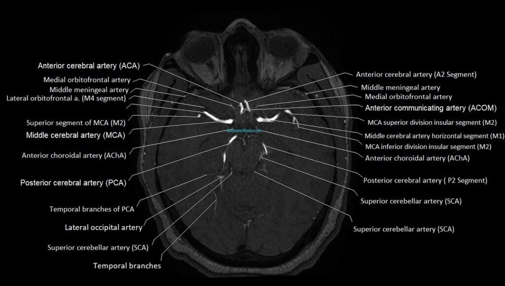 MRA brain (cerebral arteries) anatomy axial 3T image