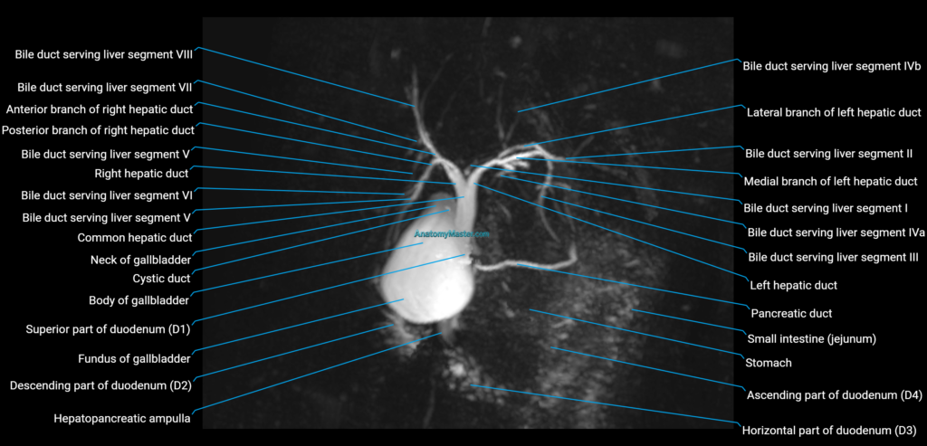 MRCP MIP MRI anatomy labelled image