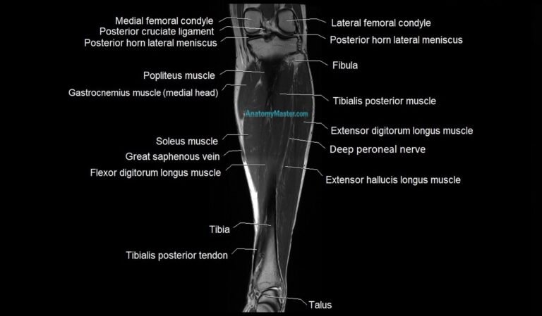 MRI Lower Leg Anatomy | High-Resolution Labelled Atlas