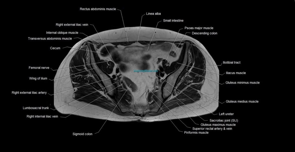 MRI 3T pelvis axial cross section anatomy image