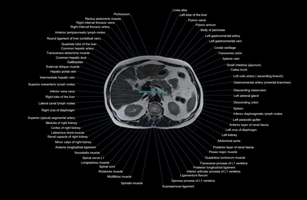 MRI Abdomen axial cross sectional anatomy radiology image