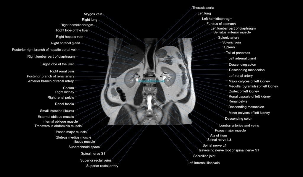 MRI Abdomen axial cross sectional anatomy radiology image