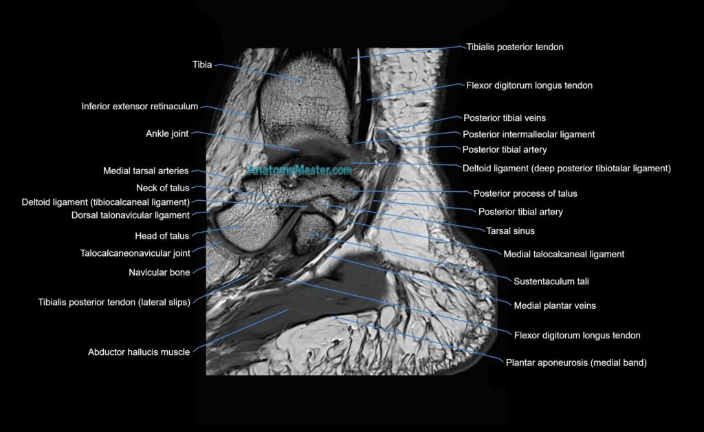 MRI Ankle sagittal cross sectional anatomy 3T radiology image