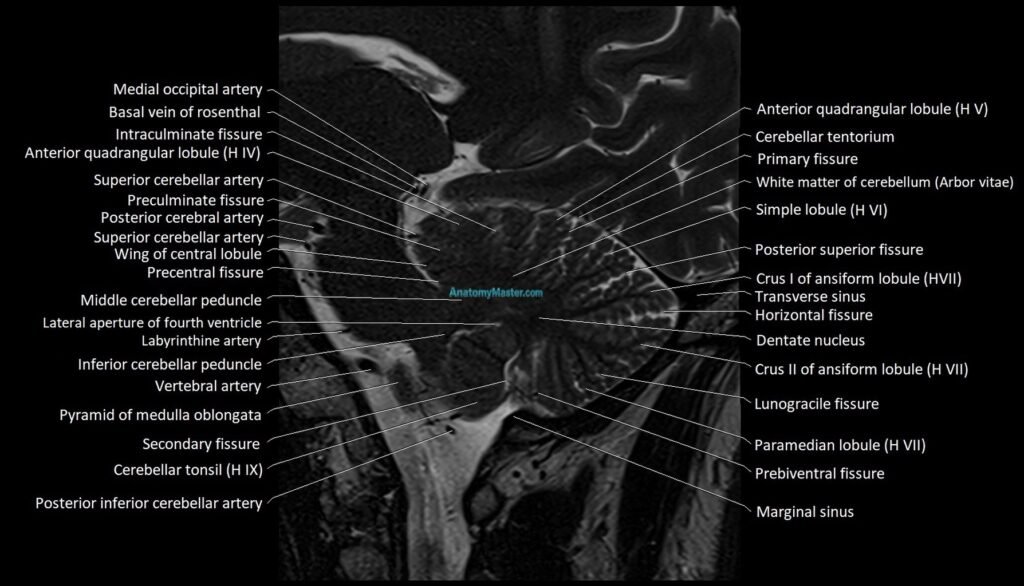 MRI Cerebellar anatomy sagittal High-resolution labelled image