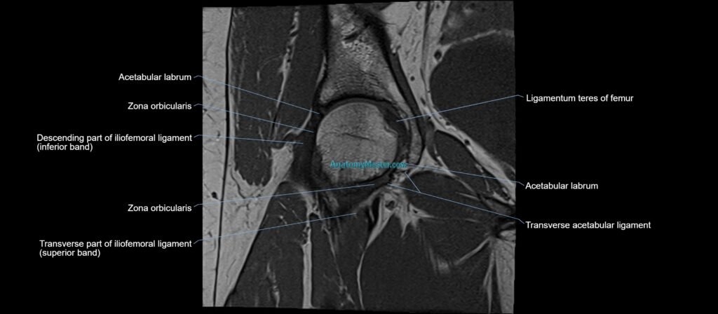 MRI Hip ligaments coronal cross sectional anatomy 3T radiology image