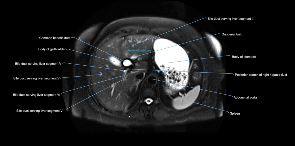 MRI MRCP axial cross sectional anatomy 3T radiology image