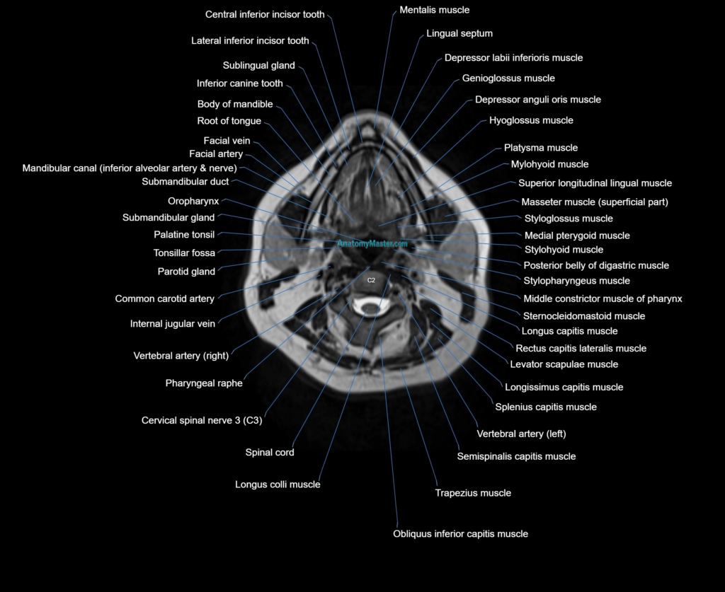 MRI Neck 3D labelled cross section anatomy axial 3t image