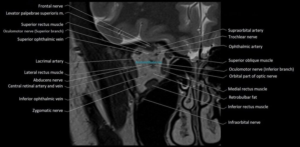 MRI Orbit coronal cross sectional anatomy image