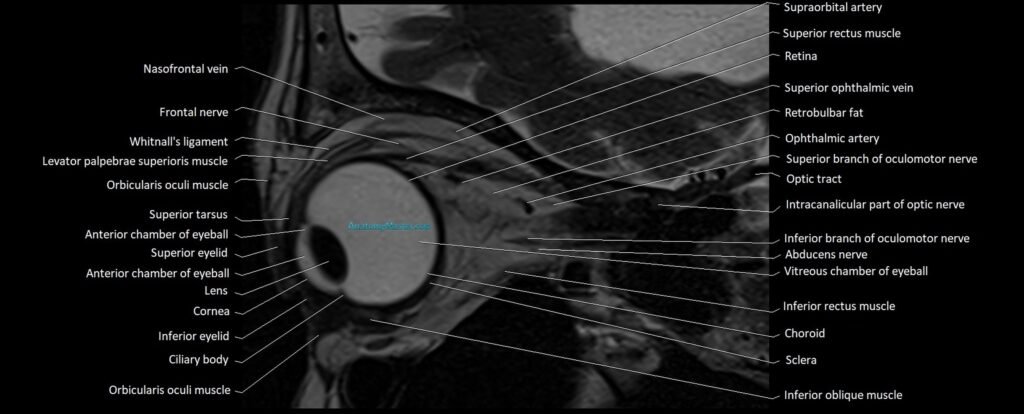 MRI Orbit sagittal cross sectional anatomy 3T image