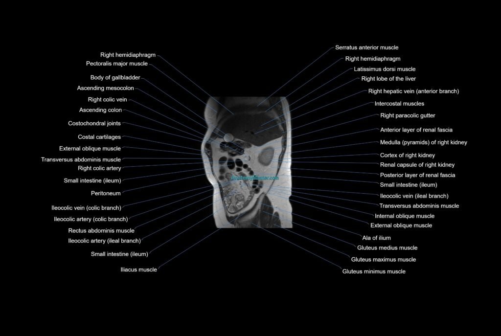 MRI abdomen sagittal cross sectional anatomy radiology image