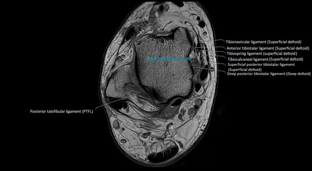 MRI ankle ligaments anatomy axial