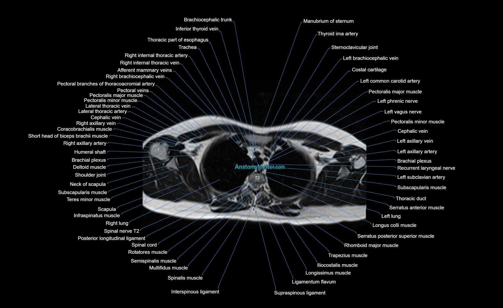 MRI Chest Anatomy | High-Resolution Labelled Atlas