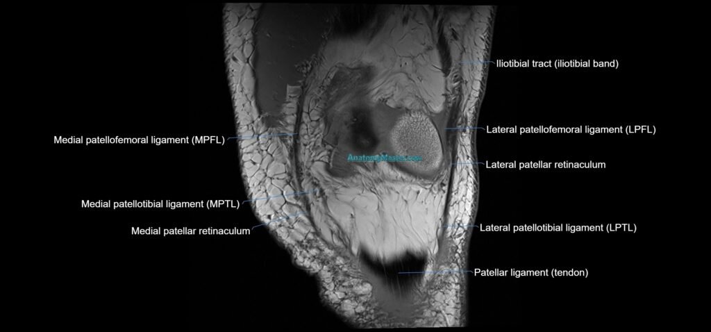 MRI coronal ligaments cross sectional anatomy 3T radiology image