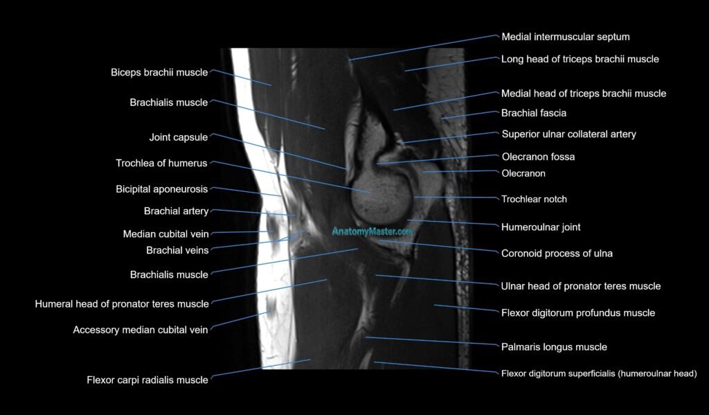 MRI elbow joint sagittal cross sectional anatomy 3T radiology image