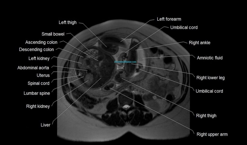 MRI fetal anatomy axial