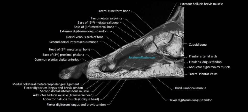 MRI foot sagittal cross sectional anatomy 3T radiology image