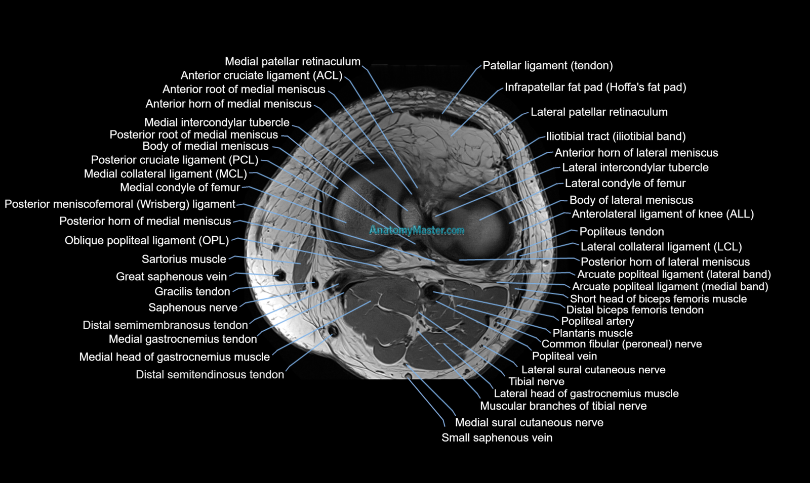 MRI Knee Anatomy | High-Resolution Labelled Atlas