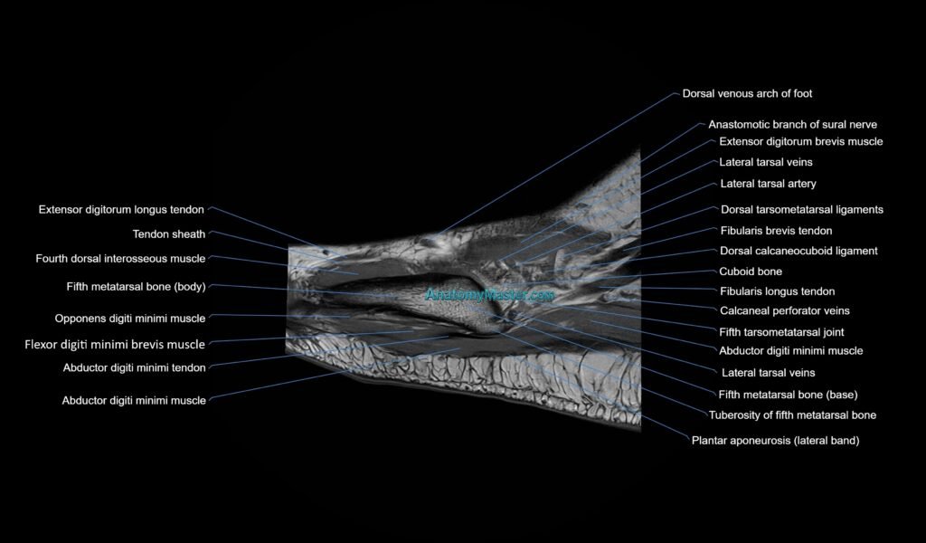 MRI mid foot sagittal cross sectional anatomy 3T radiology image