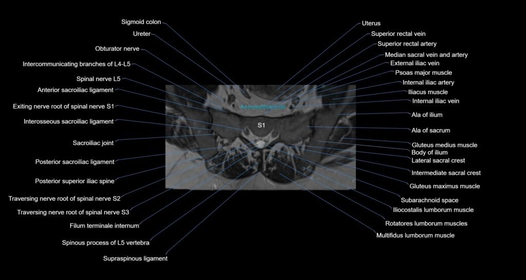 MRI sacrum, coccyx and sacroiliac joint axial cross sectional anatomy 3T radiology image