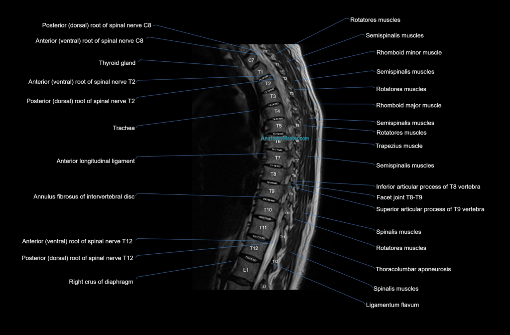 MRI thoracic spine sagittal cross sectional anatomy 3T radiology image