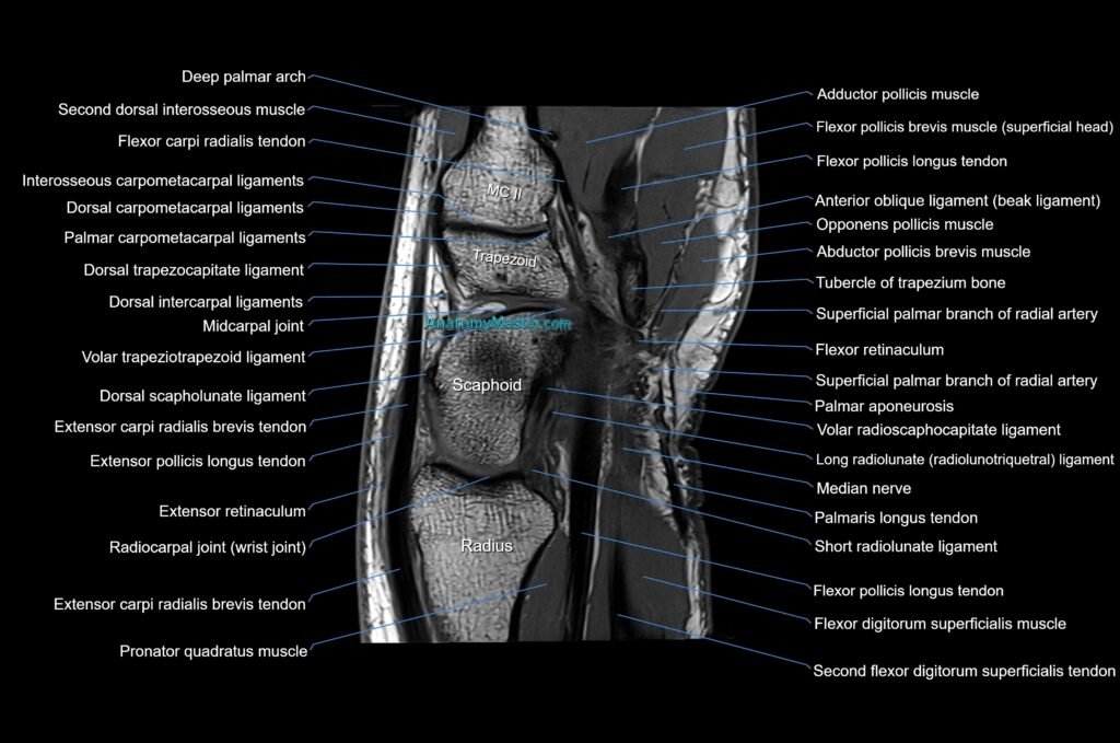 MRI wrist sagittal cross sectional anatomy 3T radiology image