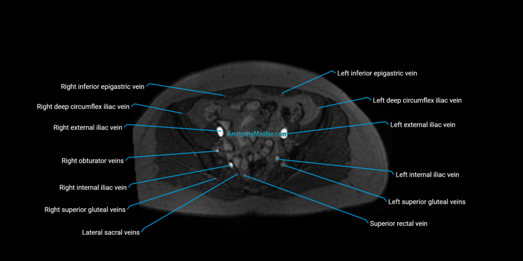 MRV Abdomen, Pelvis and Lower Limb Anatomy image 2