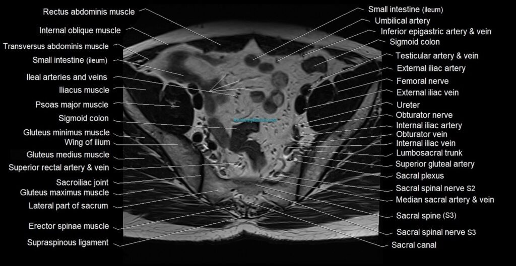 Male pelvis axial cross sectional anatomy image