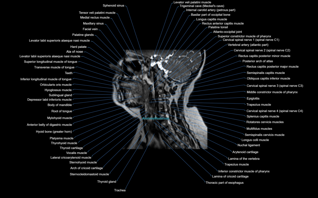 Neck MRI sagittal cross sectional anatomy 3D 1mm 3T radiology image