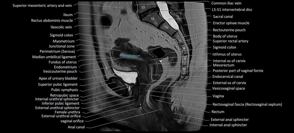 Sagittal cross sectional anatomy of female pelvis (MRI 3T) image