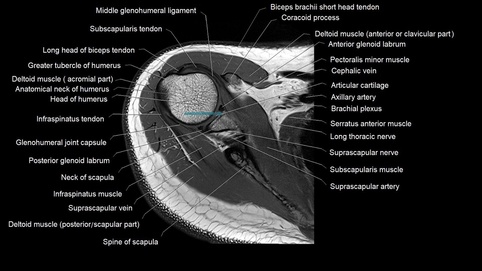 Shoulder Geode MRI Shoulder Anatomy | High-Resolution Labelled Atlas