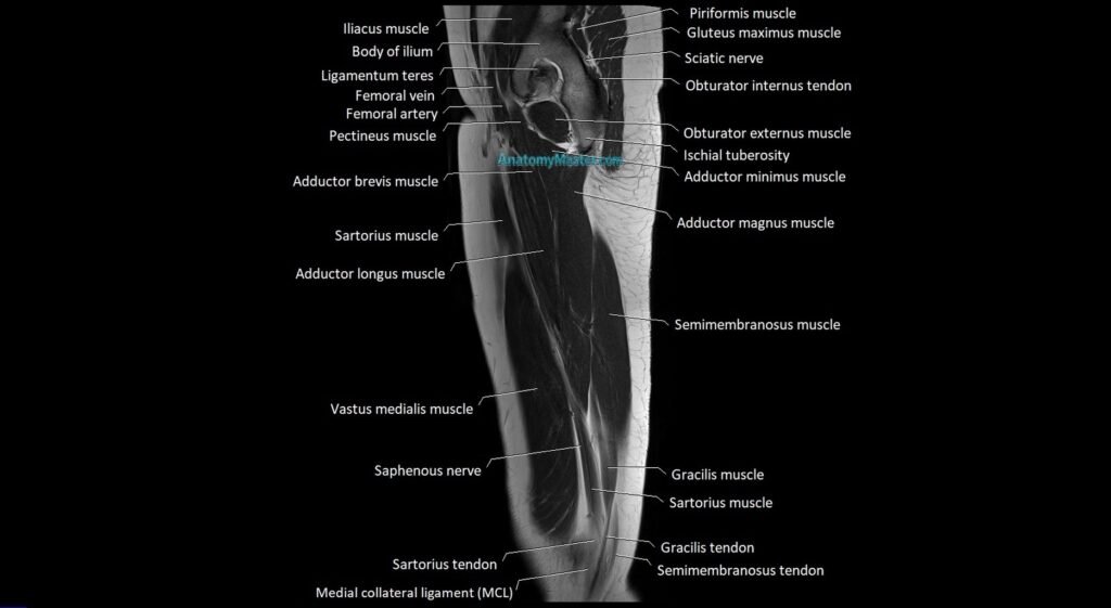 Thigh sagittal cross sectional anatomy MRI 3T image
