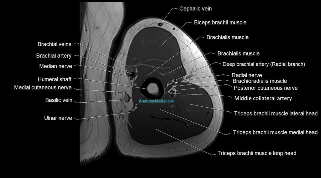 Upper arm( humerus) cross section anatomy MRI 3T axial image