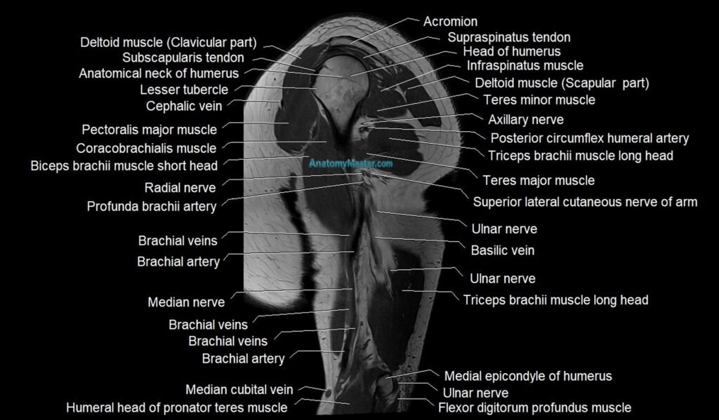 Upper arm (humerus ) saittal cross sectional anatomy 3T image