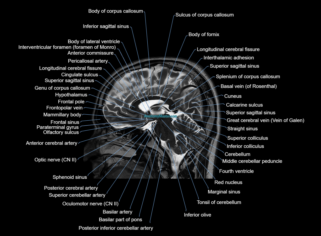 Brain sagittal anatomy 3T MRI image