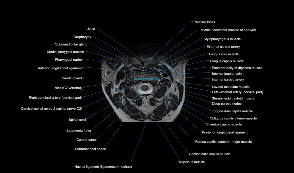 cervical spine cross sectional MRI anatomy 3T MRI axial image