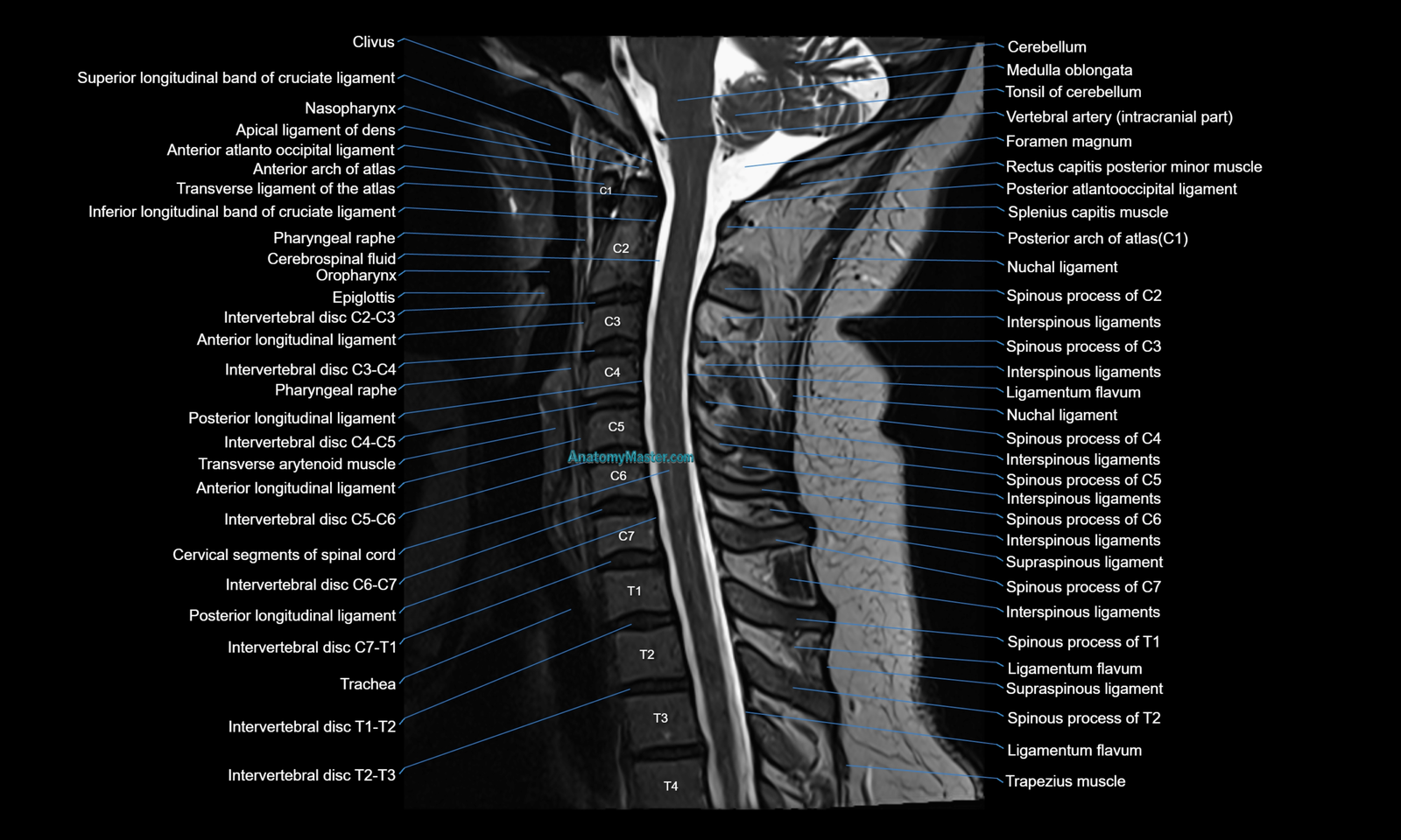 MRI Cervical Spine Anatomy | Labelled Atlas