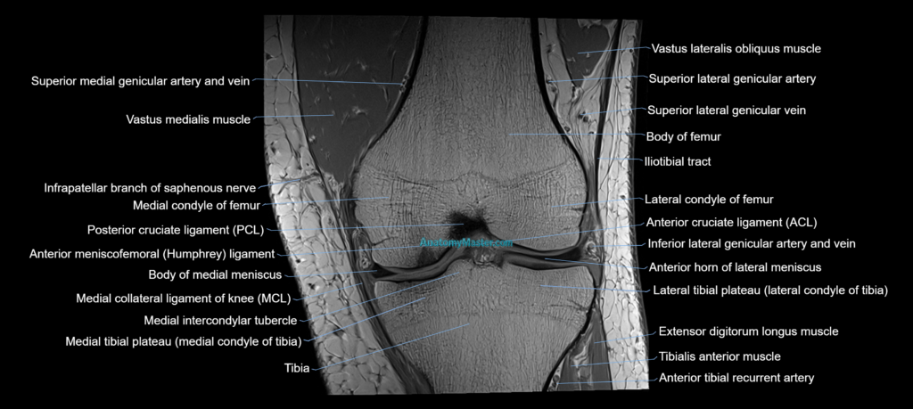 MRI knee coronal cross sectional anatomy 3T radiology image