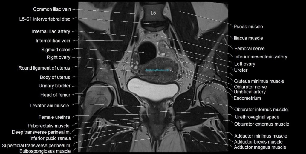 female pelvis coronal cross sectional anatomy image