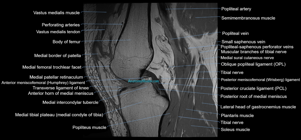MRI knee sagittal cross sectional anatomy 3T radiology image