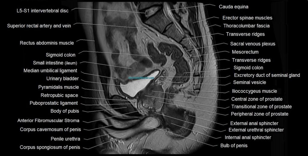 male pelvis sagittal cross sectional anatomy 3T mri image