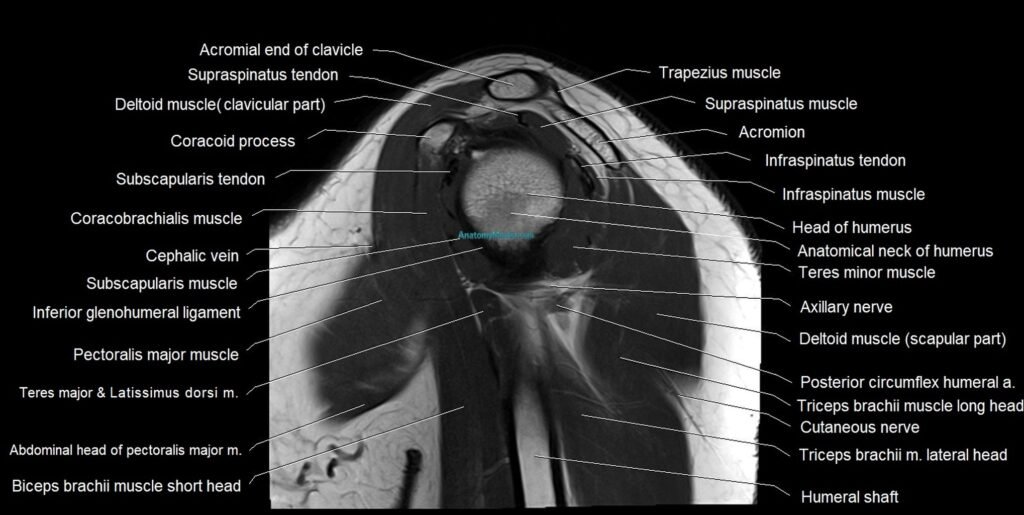 mri shoulder sagittal cross sectional anatomy image